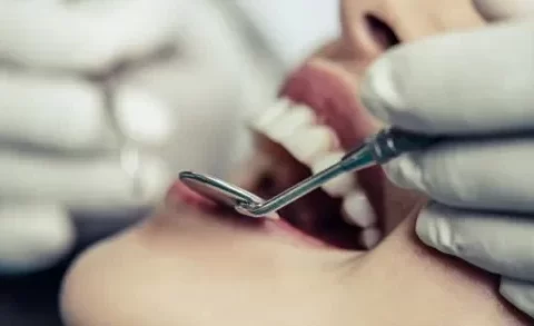 Dentes fracos: entenda as causas e como tratar