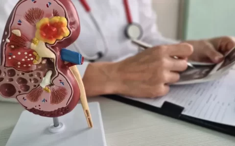 Câncer renal deve crescer quase 80% no Brasil e na América Latina até 2050