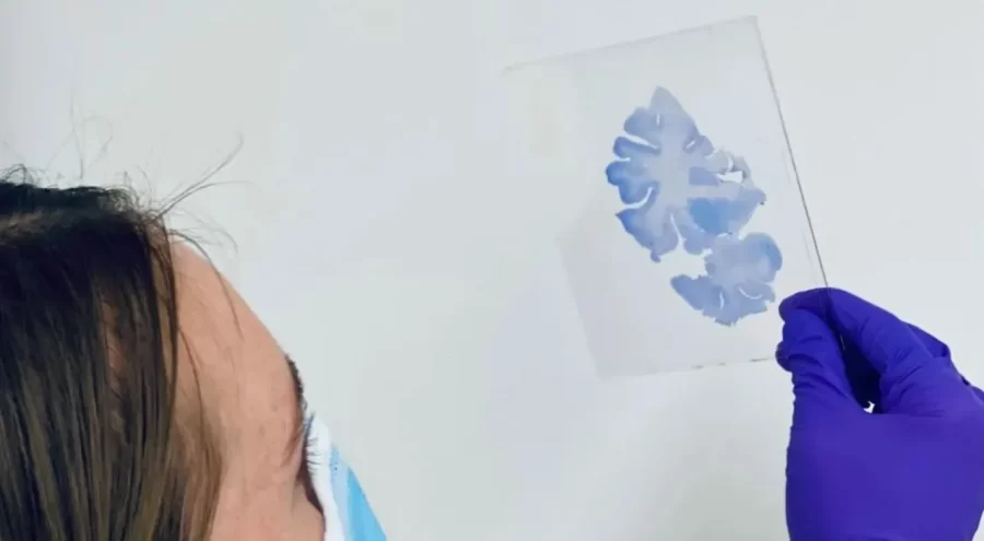 Cérebro de um “superidoso” de 80 anos funciona como o de uma pessoa de 50