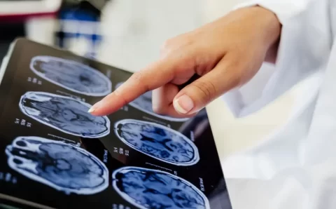 Cirurgia cerebral pode tratar depressão resistente; entenda como funciona