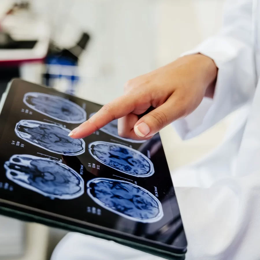 Cirurgia cerebral pode tratar depressão resistente; entenda como funciona