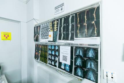 Cuiabá já oferece mamografia e ressonância para mulheres