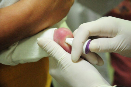 MT Hemocentro atende quase 600 pacientes com a doença falciforme