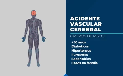 AVC mata uma pessoa a cada seis minutos no Brasil