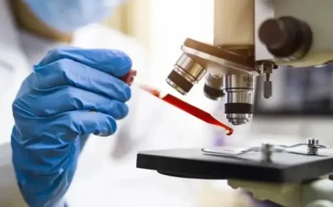 Cientistas brasileiros avançam diagnóstico de Alzheimer por exame de sangue