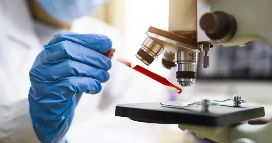 Cientistas brasileiros avançam diagnóstico de Alzheimer por exame de sangue