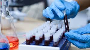 Doença faz homem ter nível de gordura no sangue 30 vezes acima do normal