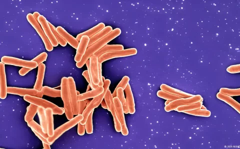 Brasil não atinge meta da OMS para reduzir tuberculose