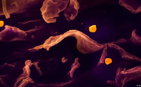 O que é e quais são os sintomas do vírus Nipah