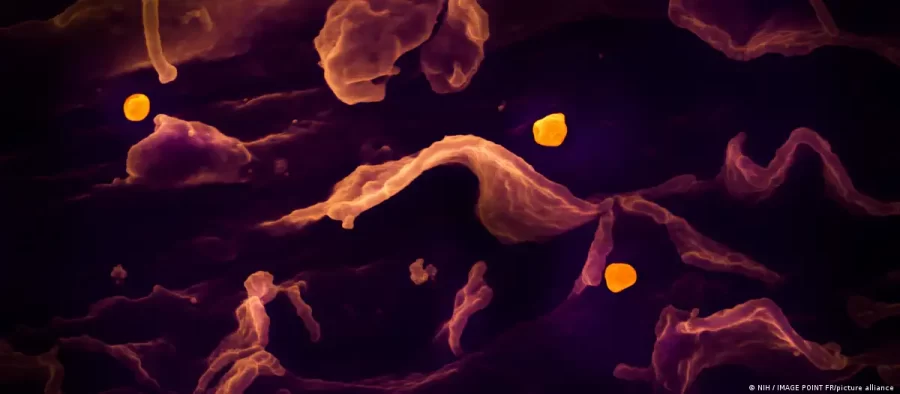 O que é e quais são os sintomas do vírus Nipah