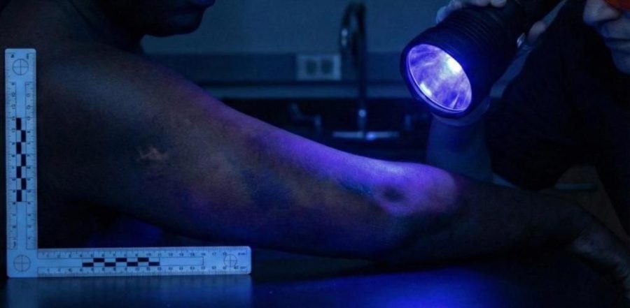 Estudo avalia a eficiência do uso de luzes forenses na detecção de hematomas em pessoas negras
