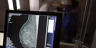 Estudo com RNA tem método que pode ajudar a tratar câncer de mama