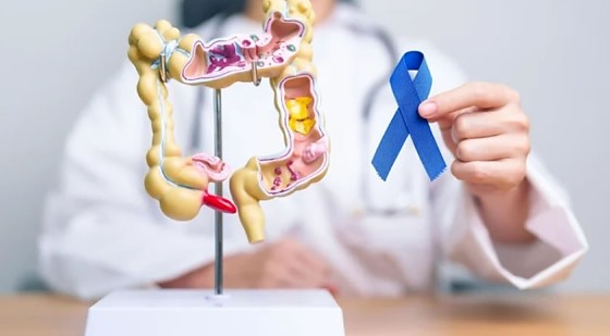 MT:  MARÇO AZUL-MARINHO:    MT deve registrar 520 novos casos de câncer colorretal por ano até 2028