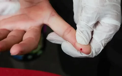 Teste rápido de dengue passa a integrar tabela do SUS