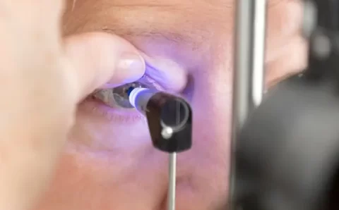 Glaucoma atinge 4% das pessoas acima de 40 anos