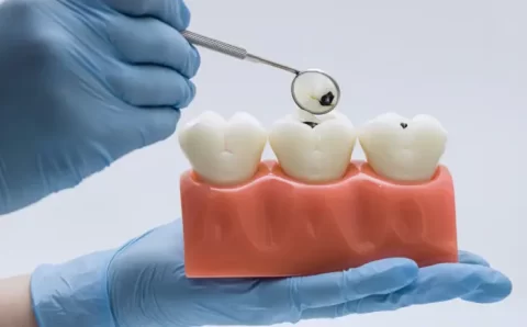 Alimentos “inofensivos” podem destruir o esmalte dos dentes; veja