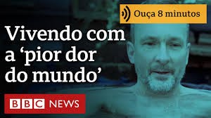 ‘Era como se alguém estivesse enfiando uma chave de fenda no meu rosto’
