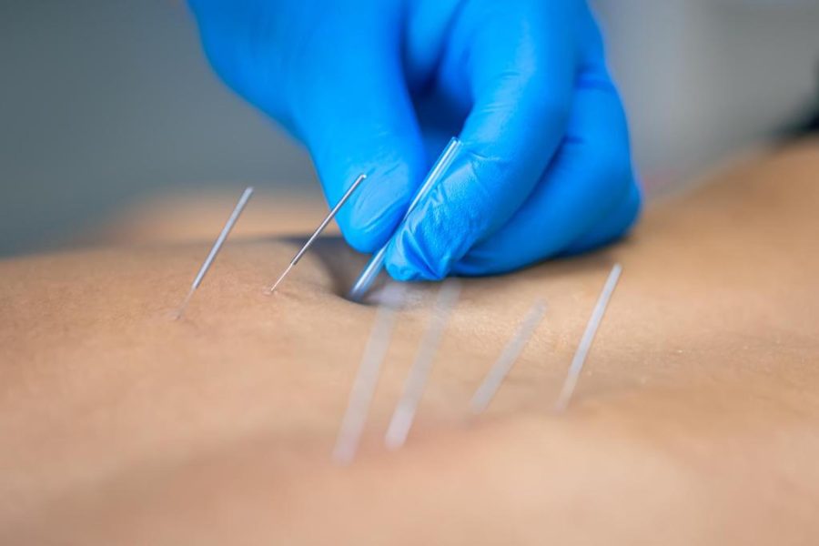 SES promove curso de acupuntura para médicos da Atenção Básica