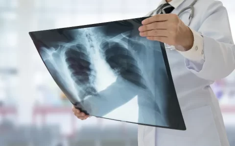 MT:  Cuiabá está entre as 13 capitais brasileiras com risco para Síndrome Respiratória Grave
