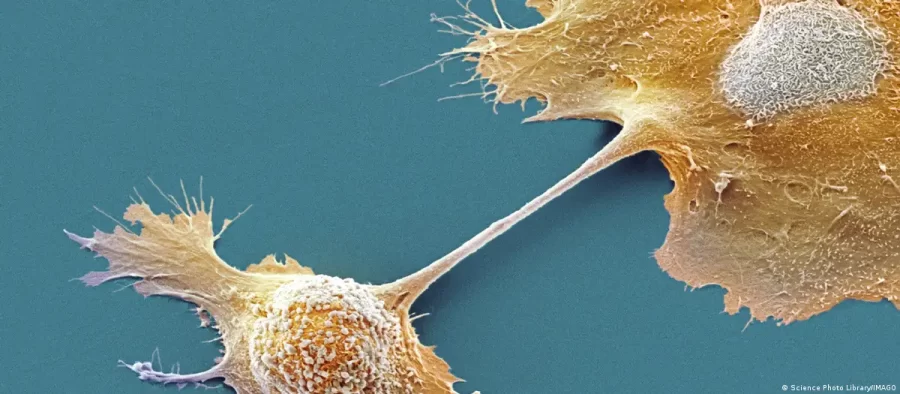 Medicamento prolonga vida de pessoas com câncer de pâncreas
