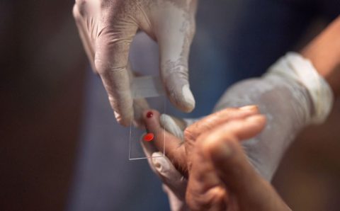 Pesquisa da Fiocruz abre caminho para vacina universal contra Malária